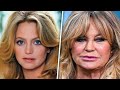 BOTCHED Surgeries That Left Celebrities Unrecognizable