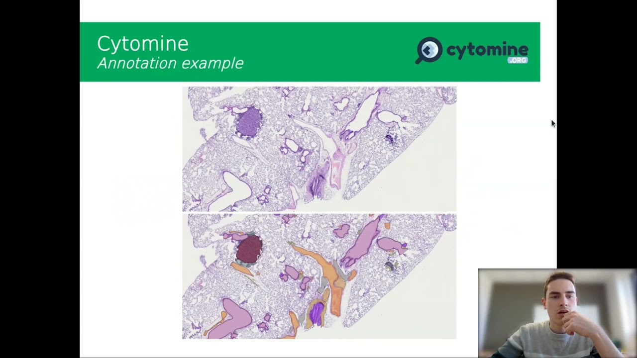 Annotation with LABELME and CYTOMINE