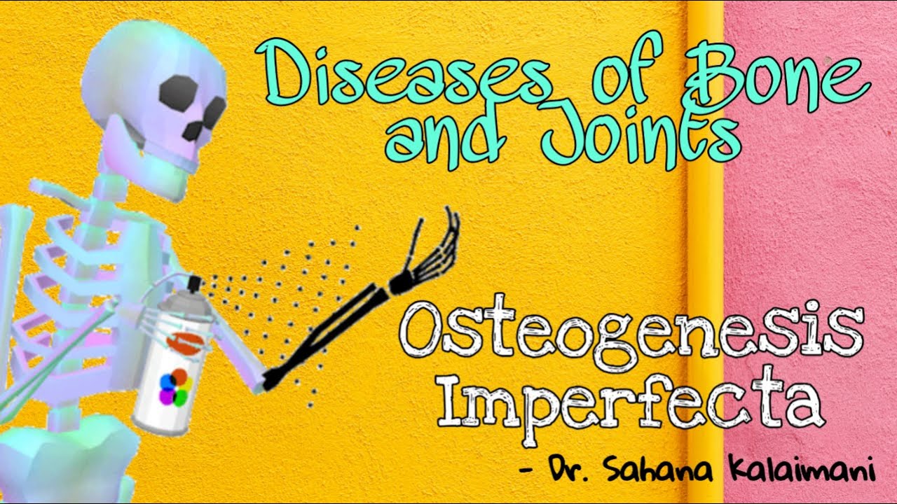 Explained easily : Diseases of bones and joints : Osteogenesis Imperfecta