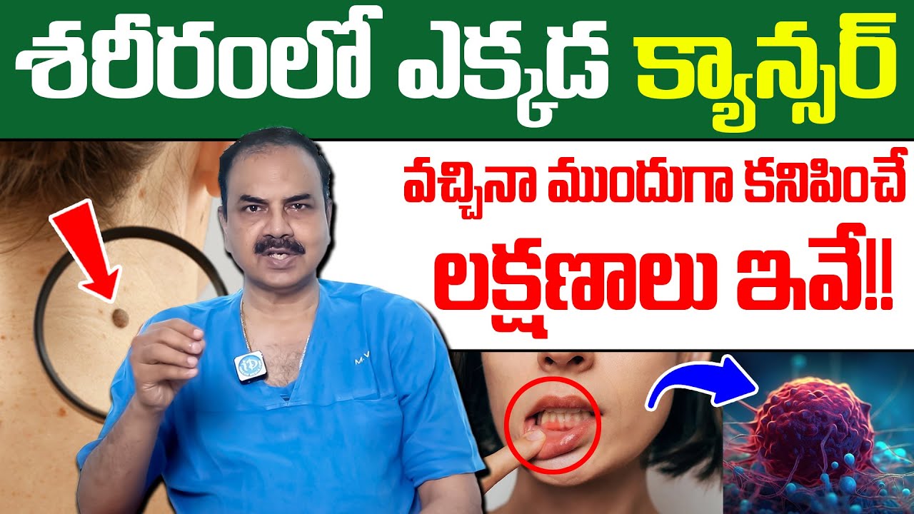 క్యాన్సర్ ఎక్కడ వచ్చినా ముందుగా కనిపించే లక్షణాలు ఇవే.! | Cancer Symptoms | Dr Mohana Vamsy | iDream