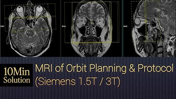 How to MRI of Orbit Planning SIEMENS 3T 1.5T