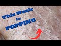 This week in popping 3