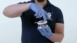 9. Mounting casts in a mechanical articulator
