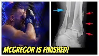 Conor McGregor&#39;s Career is Officially Over? 😱