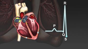 Electrocardiograph