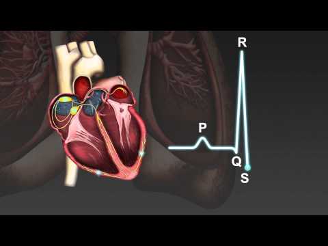 Video: Hva er hensikten med å standardisere elektrokardiografen?