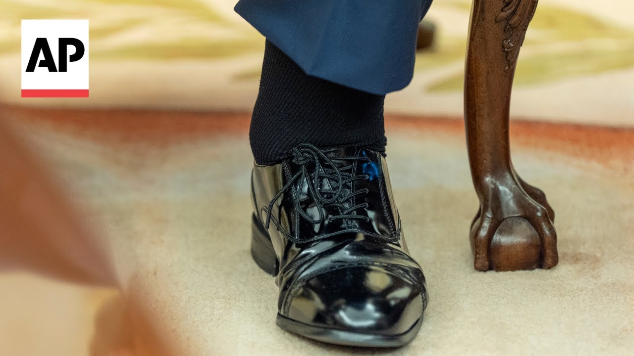 What is chronic venous insufficiency? Vascular surgeon explains