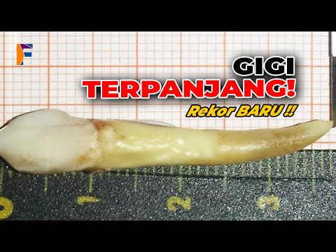 Video: 3 Garis Zip Terpanjang Di Dunia