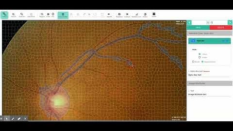 High Resolution Images SuperPixel Segmentation