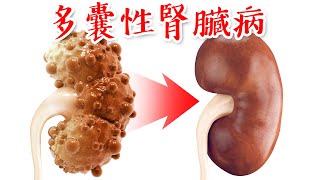 慢性腎臟病、多囊性腎臟病的真正原因,自然療法,柏格醫生 Dr Berg