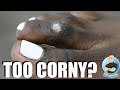 NOT YOUR TYPICAL CORN REMOVAL ***CORNY SURPRISE?!***