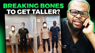 Orthopedic Surgeon Reacts | Breaking your Bones to Make you TALLER!