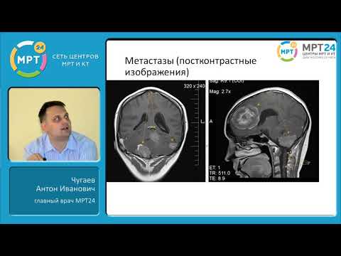МРТ диагностика опухолей головного мозга
