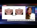 Les facettes dentaires pour embellir son sourire - (C NEWS 24/02/2019)