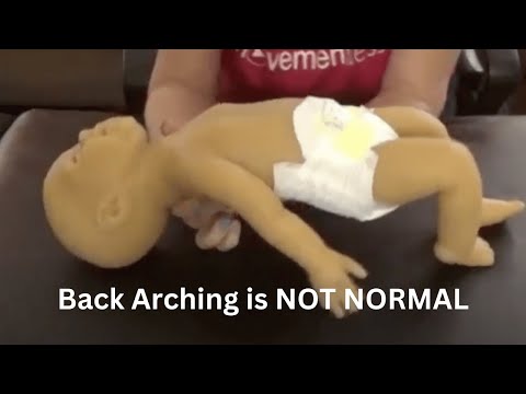 Vídeo: Baby Arching Back: Causas, Soluciones Y Cuándo Preocuparse