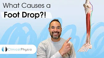 What Causes a Foot Drop?! | Expert Physio Explains Most Common Reasons!