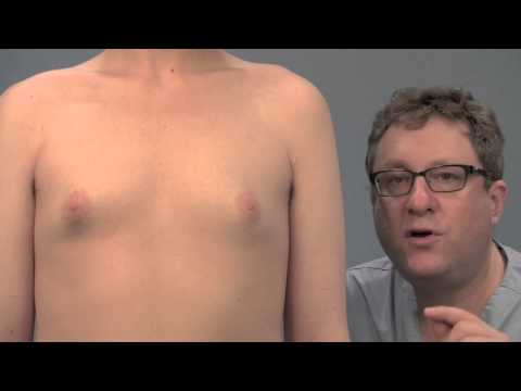 Causes and treatments for puffy nipples in men, explained by Dr. Steven Teitelbaum