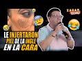 José Luis Zagar -Le injertaron piel de la ingle en la cara