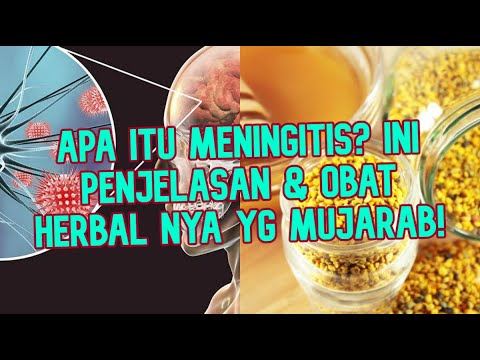 cara-mengobati-meningitis-secara-alami