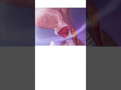 epiglottis movement ,