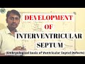 DEVELOPMENT OF INTERVENTRICULAR SEPTUM | VSD