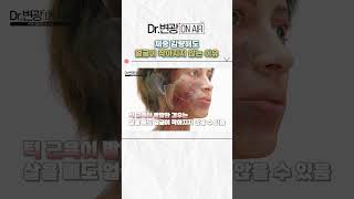 체중 감량해도 얼굴이 작아지지 않는 이유는?