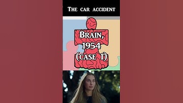 Aphantasia case study (Brain, 1954, case 1) #neuroscience #psychology #casestudy #brain