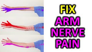 3 Exercise To Relieve Arm Pain, Numbness, Pins and Needles