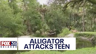 Florida boy bitten by alligator while swimming in creek