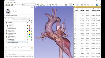 New vessel branch extraction module for 3D Slicer