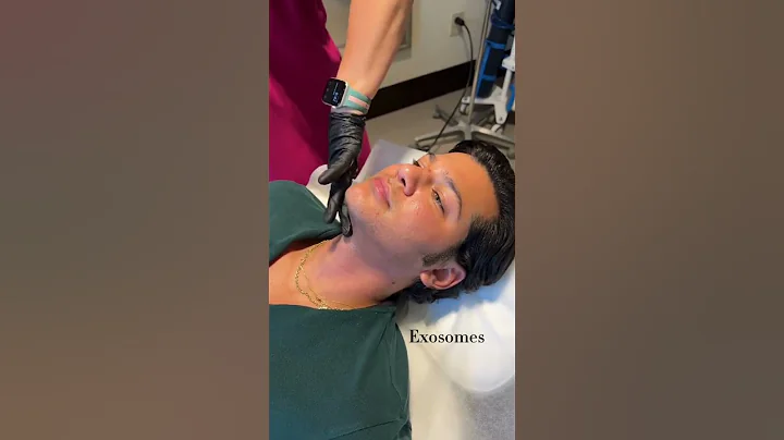 Morpheus8 - This treatment uses microneedling with radio #beauty #skincare #shorts