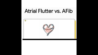 Atrial Flutter vs Atrial Fibrillation