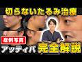 切開なしでたるみ改善！実際にアッティバを受けた患者様の症例をお見せします。