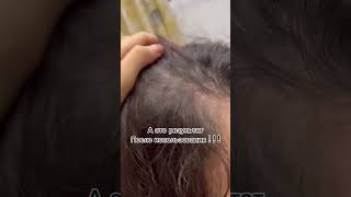 Арт на ВБ WW115530#пилинг  #scalphair #косметика #бьюти #находкавб#уходзаволосами