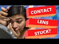 How Do I Get a Stuck Contact Lens Out of My Eye?