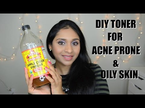 DIY Toner for Acne Prone & Oily Skin| Home Remedies For Acne