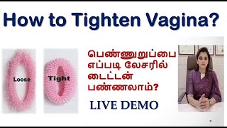 Famous Live demo பெண்ணுறுப்பை எப்படி லேசரில் டைட்டன் பண்ணலாம் | Laser Vaginal Tightening | Dr.Deepa Ganesh. Profile