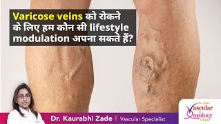 Varicose veins को रोकने के लिए हम कौन सी lifestyle modulation अपना सकते हैं | Dr Kaurabhi Zade