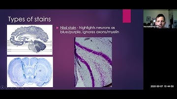 (Some) Ways that brain tissue is stained