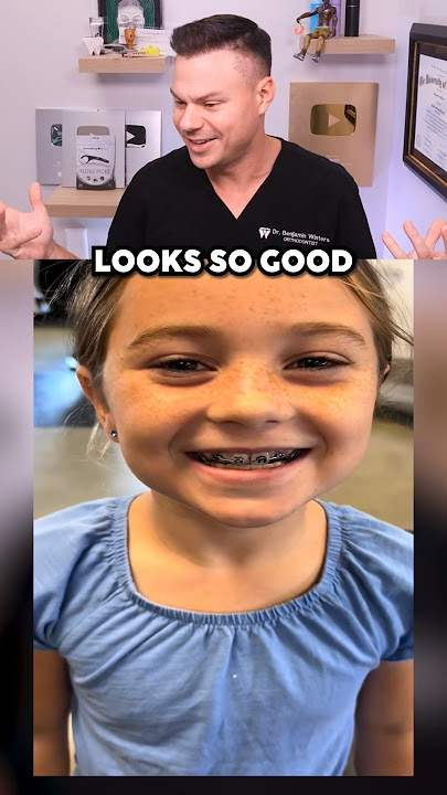 Are These Braces REAL Or FAKE?! 😮🦷