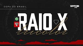 RAIO-X TRICOLOR: JUVENTUDE X SÃO PAULO | COPA DO BRASIL 2026