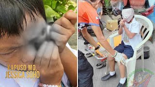 Grade 2 Pupil Sa Cebu City, Aksidenteng Natusok Ng Bakal Ang Kaliwang Mata Kapuso Mo, Jessica Soho