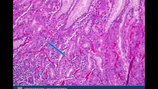 Histology of the Stomach - PathologyNOW