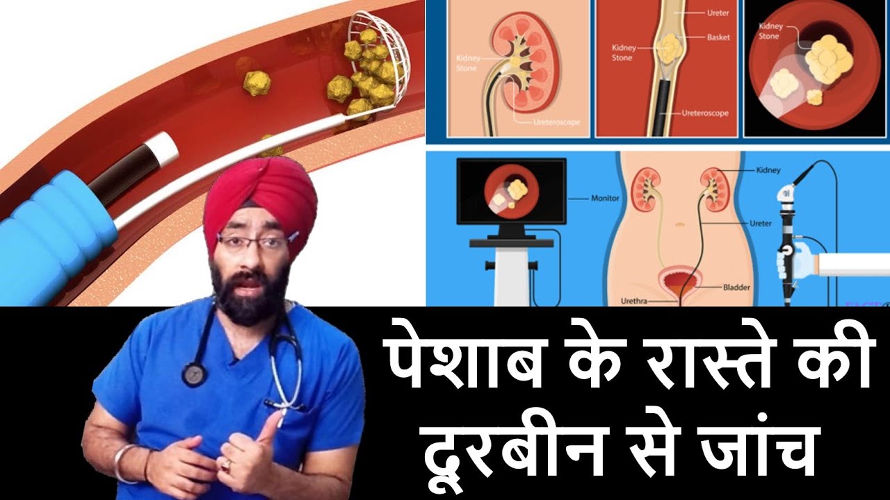 What is Ureteroscopy | दूरबीन से पेशाब के रास्ते की जांच | Dr.Education
