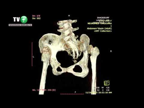 tratamentul articulației hock durere în articulația cotului și ligamente