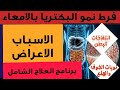 الحل النهائي لانتفاخات البطن ونوبات الخوف والهلع البرنامج الكامل لعلاج فرط نمو البكتريا بالامعاء الحل النهائي لانتفاخات البطن ونوبات الخوف والهلع البرنامج الكامل لعلاج فرط نمو البكتريا بالامعاء