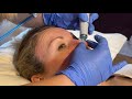 HydraFacial review: Watch one of the most popular facials up close and see the results