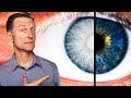 This Vitamin Reverses GLAUCOMA?!