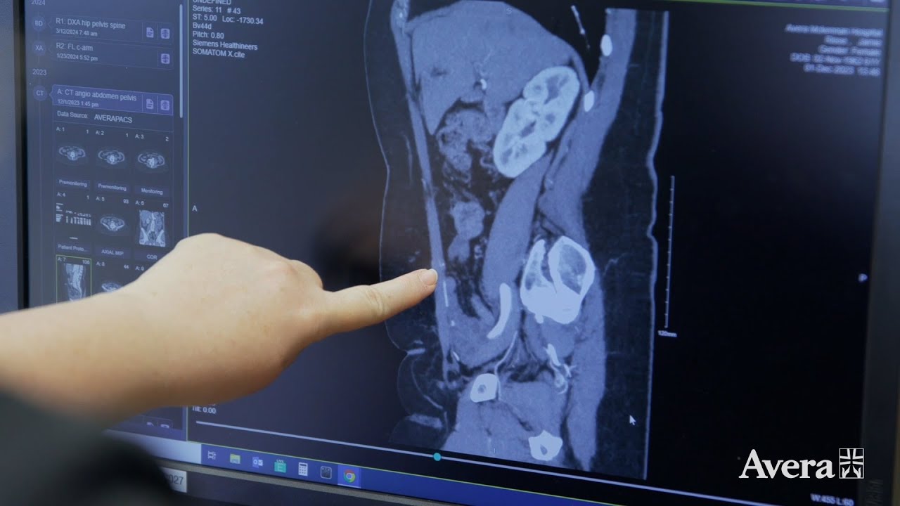 Mastectomy & Microvascular Breast Reconstruction