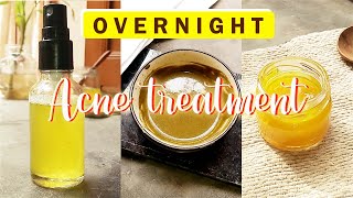 How To Remove Pimples Overnight | DIY Remedies for Skin Brightening | Overnight Aloe - turmeric mask